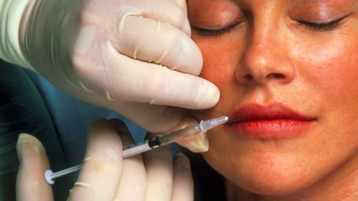 Most botox injections take place in milady