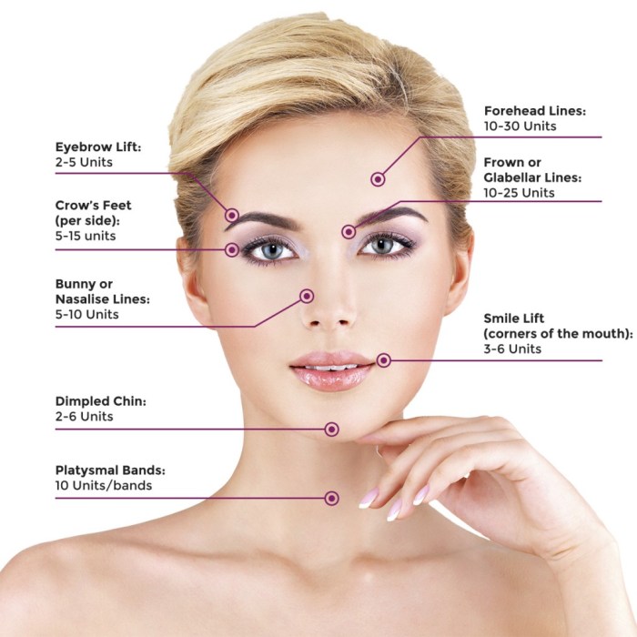 Botox neurotoxin injections injection fillers treatment face chin eyebrow brow injected drawbacks veledora dermal wrinkles marionette