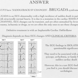 Kaiser permanente ekg test questions