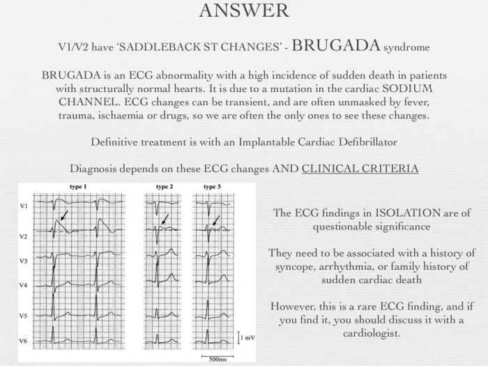 Kaiser permanente ekg test questions